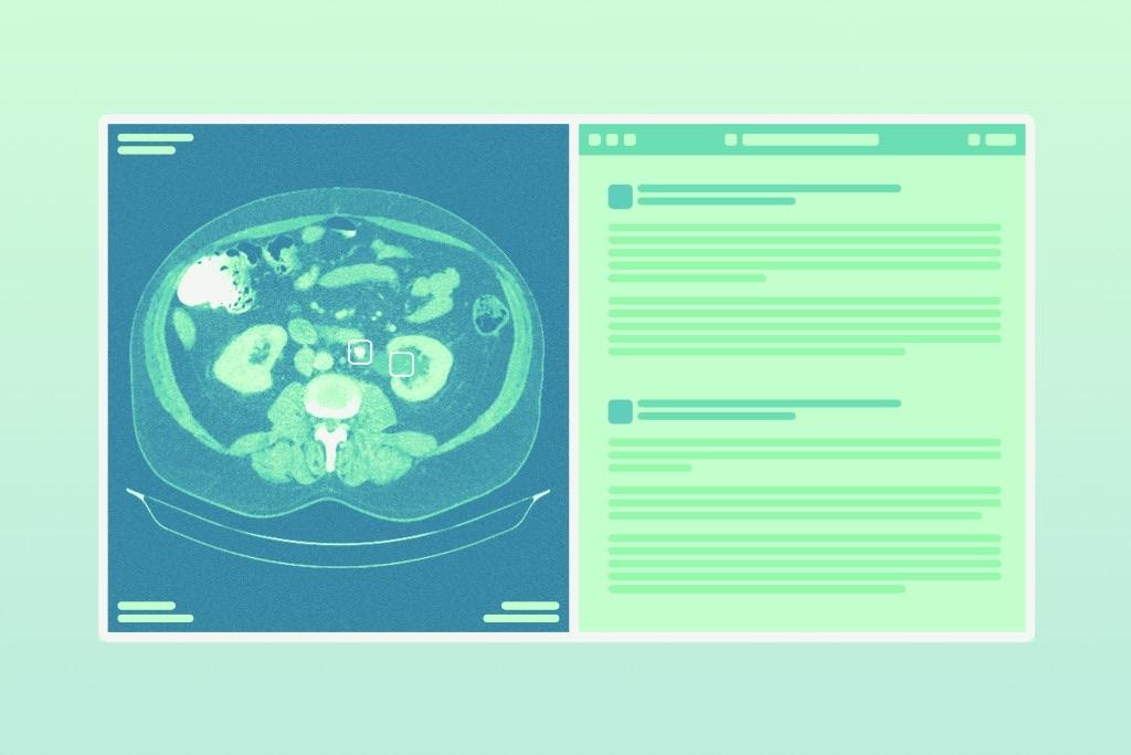 A CT scan alongside a Voio-generated radiology report